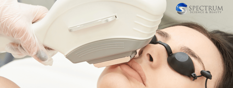 A Look into Different IPL Treatments