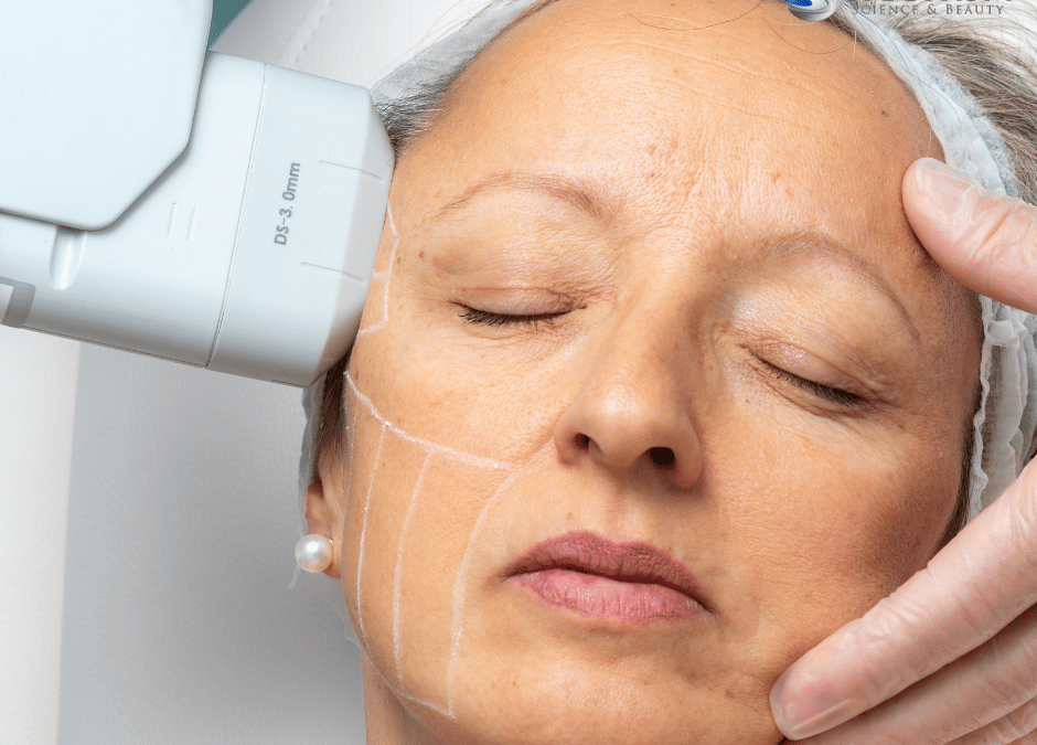 HIFU Versus Radio Frequency: Anti-Aging Beauty Treatments
