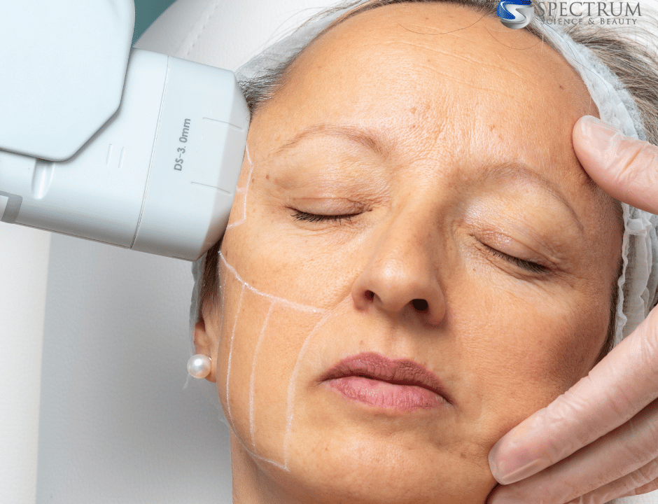 HIFU Versus Radio Frequency: Anti-Aging Beauty Treatments