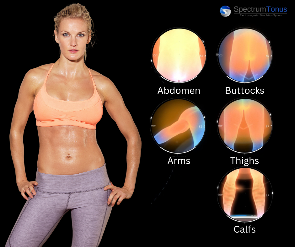Body contouring areas